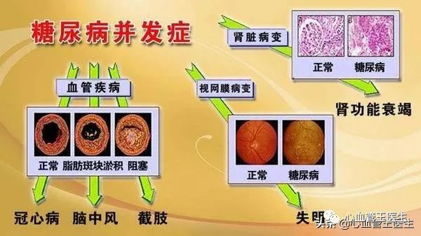 高血压,糖尿病,高脂血症三者被大家习惯叫作三高.